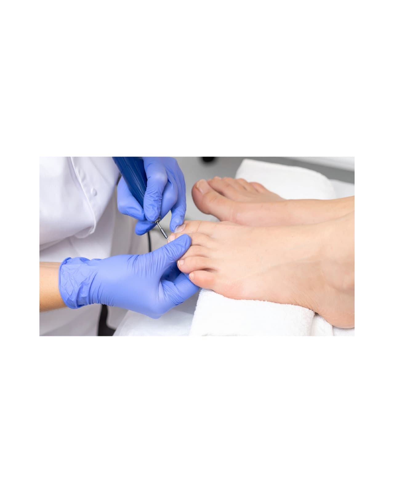 A podiatrist performing a treatment on a patient's foot